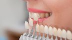 Cum putem preveni riscurile unui tratament cu fatete dentare incorect?